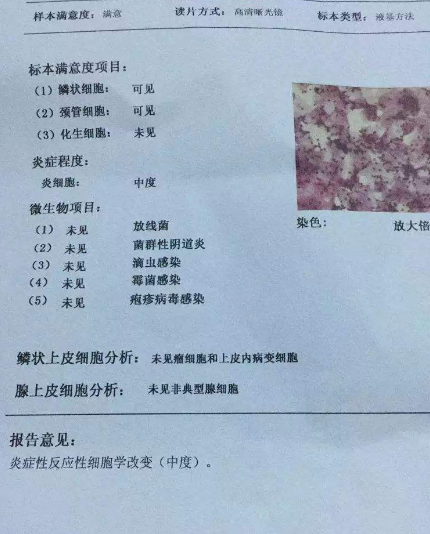 阴道分泌物幸福宝APP污版下载厂家教你查看阴道分泌物检测报告