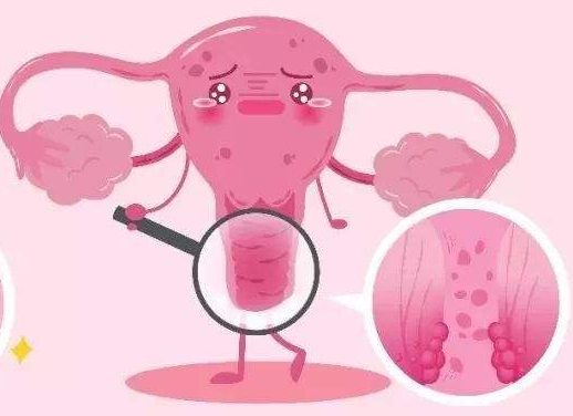 白带常规幸福宝APP最新地址厂家提醒女士做好私密处清洗