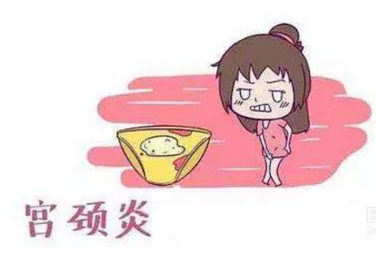妇科白带幸福宝APP污版下载厂家分析宫颈炎的症状