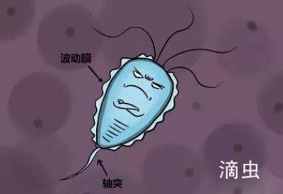 白带幸福宝APP污版下载品牌介绍滴虫性阴道炎的早期症状以及预防方法