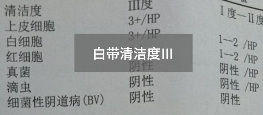 今天快讯！全自动白带幸福宝APP最新地址生产厂家幸福宝APP为您官方解释白带清洁度3的意思